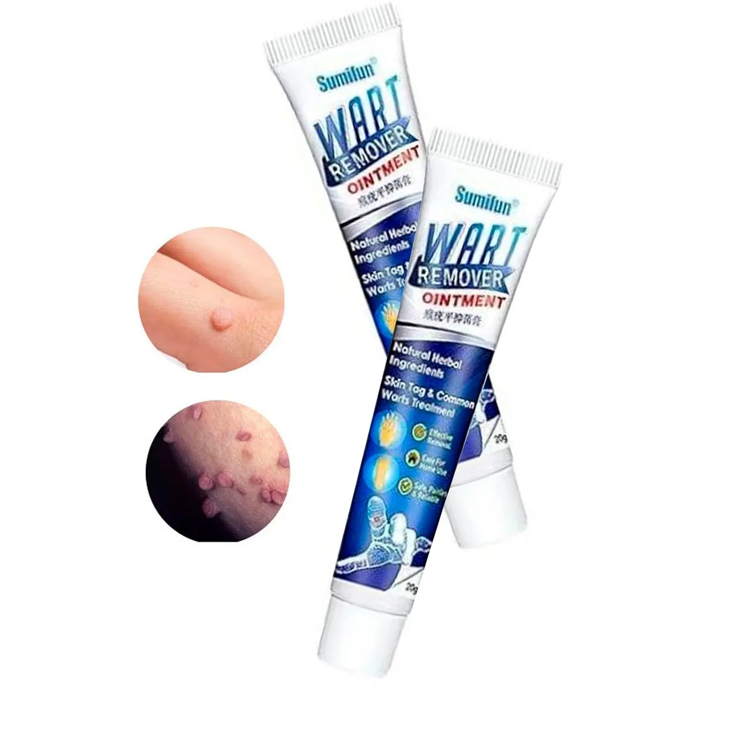 ADIÓS VERRUGAS - SUMIFUN™ CREMA PARA ELIMINAR VERRUGAS